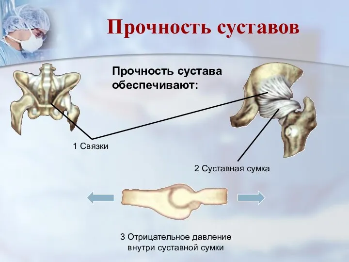 Прочность сустава обеспечивают: 1 Связки 2 Суставная сумка 3 Отрицательное давление внутри суставной сумки Прочность суставов