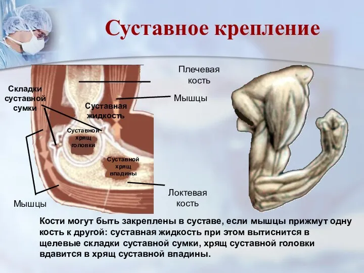 Суставной хрящ головки Складки суставной сумки Кости могут быть закреплены