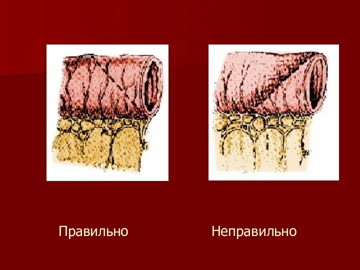 Правильно Неправильно