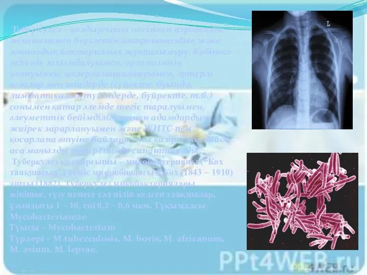 Туберкулез – қоздырғышы негізінен аэрогендік механизммен берілетін антропоноздық және зооноздық бактериялық жұқпалы ауру.