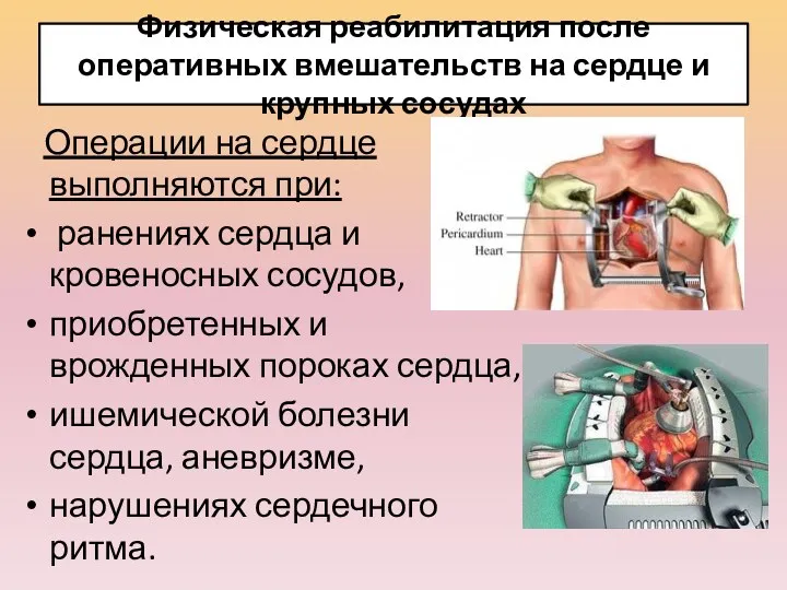 Физическая реабилитация после оперативных вмешательств на сердце и крупных сосудах