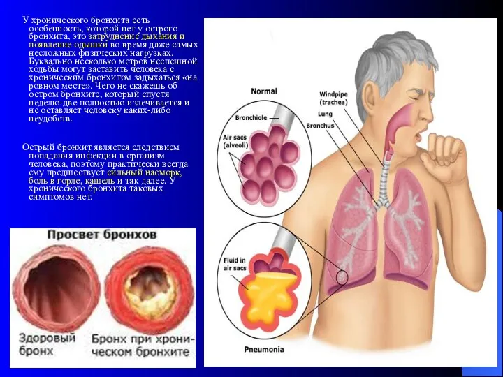 У хронического бронхита есть особенность, которой нет у острого бронхита, это затруднение дыхания
