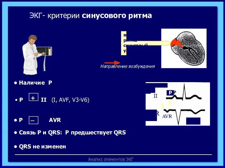 Анализ элементов ЭКГ водитель ритма- синусовый узел ЭКГ- критерии синусового ритма Р II AVR Направление возбуждения