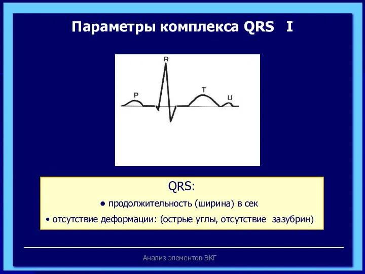 Анализ элементов ЭКГ Параметры комплекса QRS I R Q S продолжительность QRS: продолжительность