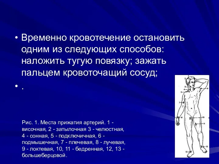 Временно кровотечение остановить одним из следующих способов: наложить тугую повязку;