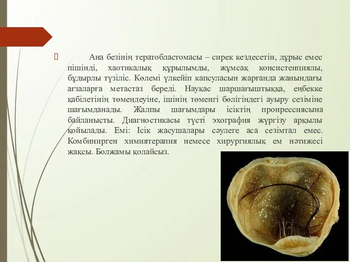 Ана безінің тератобластомасы – сирек кездесетін, дұрыс емес пішінді, хаотикалық