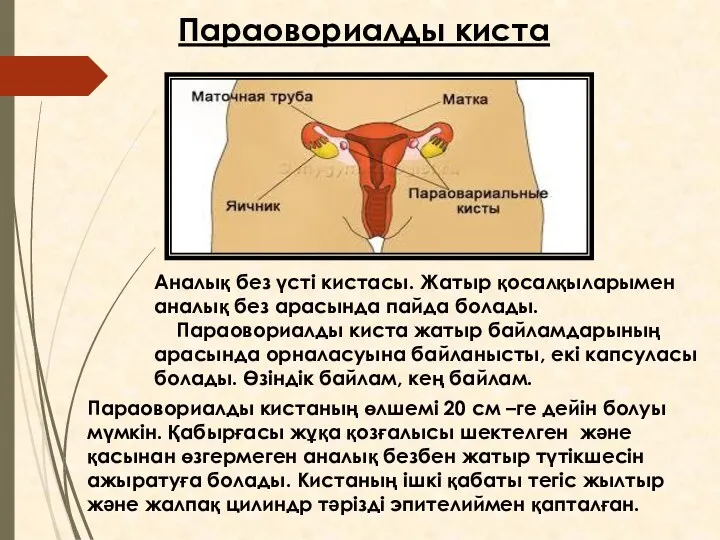 Аналық без үсті кистасы. Жатыр қосалқыларымен аналық без арасында пайда