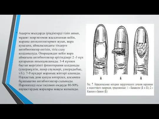 Ақырғы жылдарда іріңдіктерді тіліп ашып, мұқият некрэктомия жасалғаннан кейін, жараны антисептиктермен жуып, жара