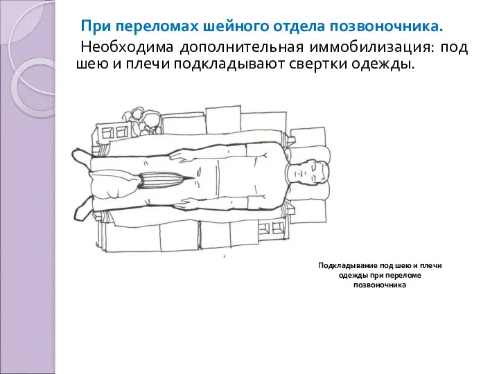 При переломах шейного отдела позвоночника. Необходима дополнительная иммобилизация: под шею