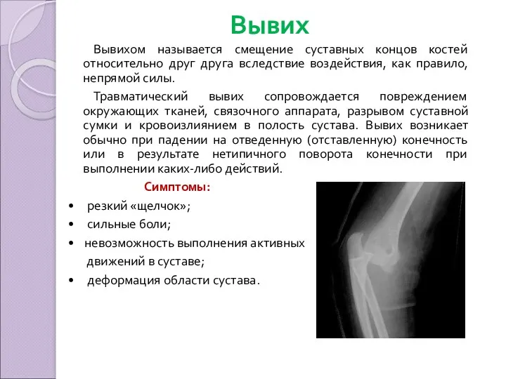 Вывих Вывихом называется смещение суставных концов костей относительно друг друга