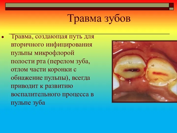 Травма зубов Травма, создающая путь для вторичного инфицирования пульпы микрофлорой