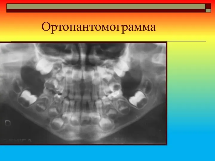 Ортопантомограмма