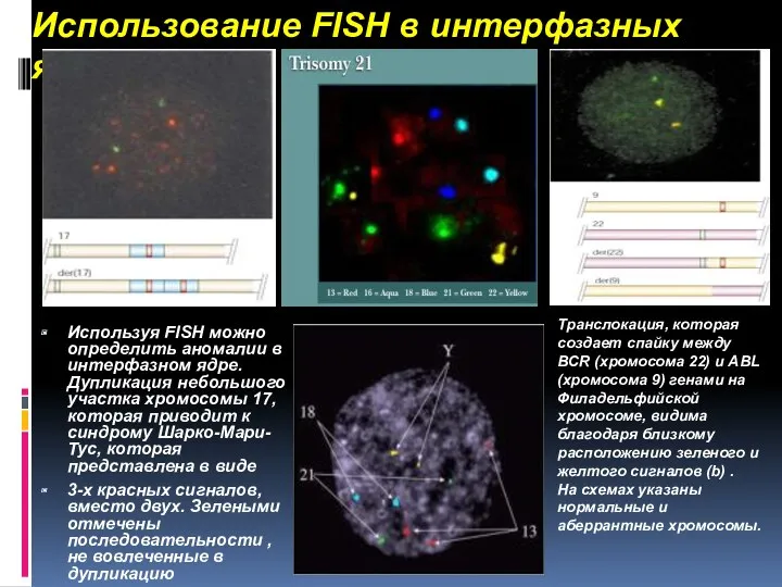 Использование FISH в интерфазных ядрах Используя FISH можно определить аномалии в интерфазном ядре.