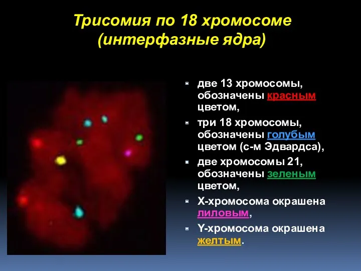 Трисомия по 18 хромосоме (интерфазные ядра) две 13 хромосомы, обозначены