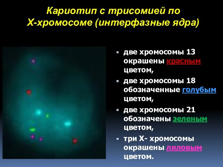 Кариотип с трисомией по Х-хромосоме (интерфазные ядра) две хромосомы 13