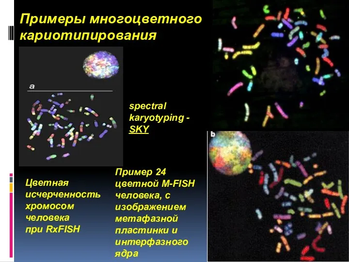 Примеры многоцветного кариотипирования . Пример 24 цветной М-FISH человека, с изображением метафазной пластинки