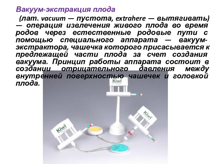 Вакуум-экстракция плода (лат. vacuum — пустота, extrahere — вытягивать) — операция извлечения живого