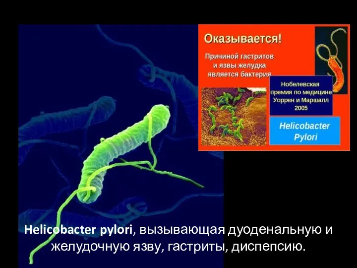 Helicobacter pylori, вызывающая дуоденальную и желудочную язву, гастриты, диспепсию.