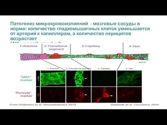 Патогенез микрокровоизлияний - мозговые сосуды в норме: количество гладкомышечных клеток уменьшается от артерий