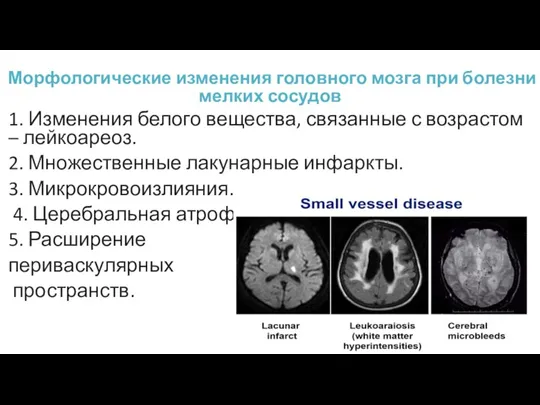Морфологические изменения головного мозга при болезни мелких сосудов 1. Изменения