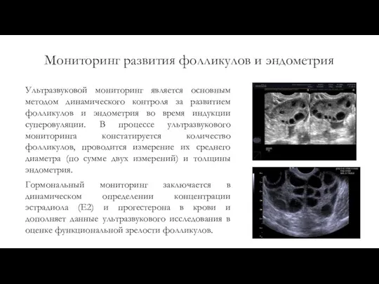 Мониторинг развития фолликулов и эндометрия Ультразвуковой мониторинг является основным методом