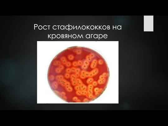 Рост стафилококков на кровяном агаре