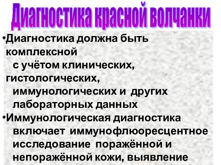 Диагностика красной волчанки Диагностика должна быть комплексной с учётом клинических,