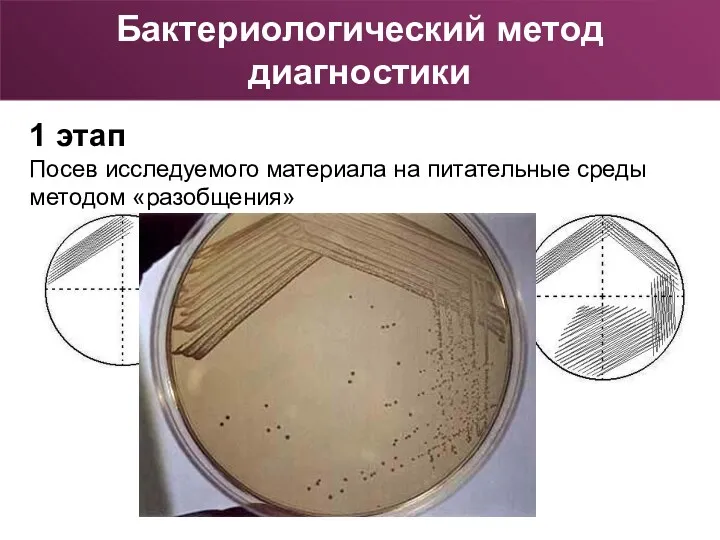 1 этап Посев исследуемого материала на питательные среды методом «разобщения» Бактериологический метод диагностики