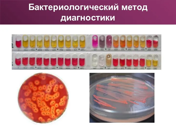 Бактериологический метод диагностики