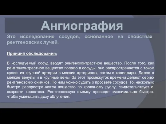 Ангиография Это исследование сосудов, основанное на свойствах рентгеновских лучей. Принцип