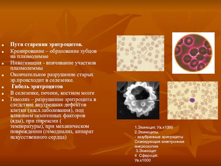 Пути старения эритроцитов. Кренирование – образование зубцов на плазмолемме Инвагинация