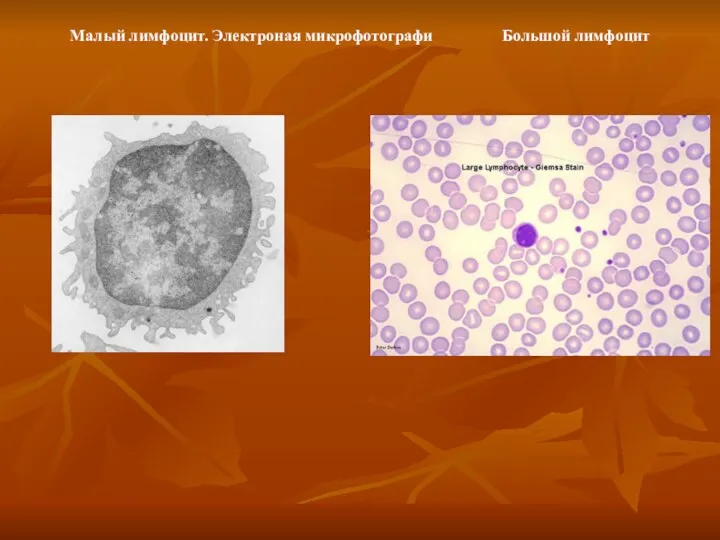 Малый лимфоцит. Электроная микрофотографи Большой лимфоцит