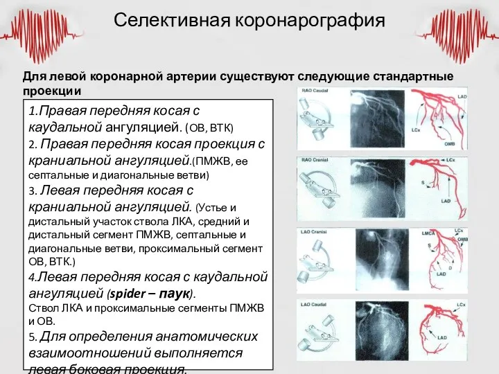 Селективная коронарография Для левой коронарной артерии существуют следующие стандартные проекции