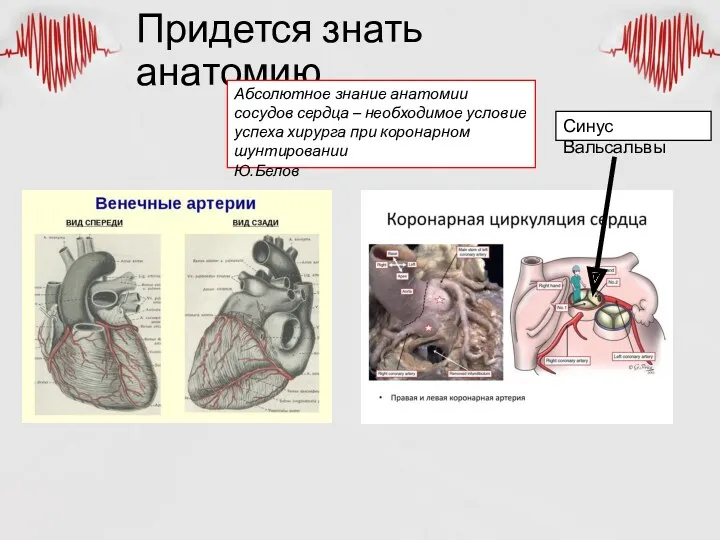 Придется знать анатомию Абсолютное знание анатомии сосудов сердца – необходимое