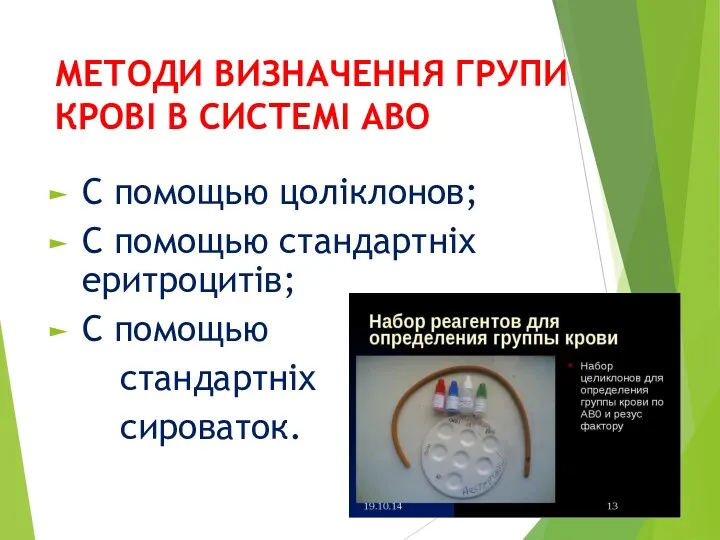 МЕТОДИ ВИЗНАЧЕННЯ ГРУПИ КРОВІ В СИСТЕМІ АВО С помощью цоліклонов;