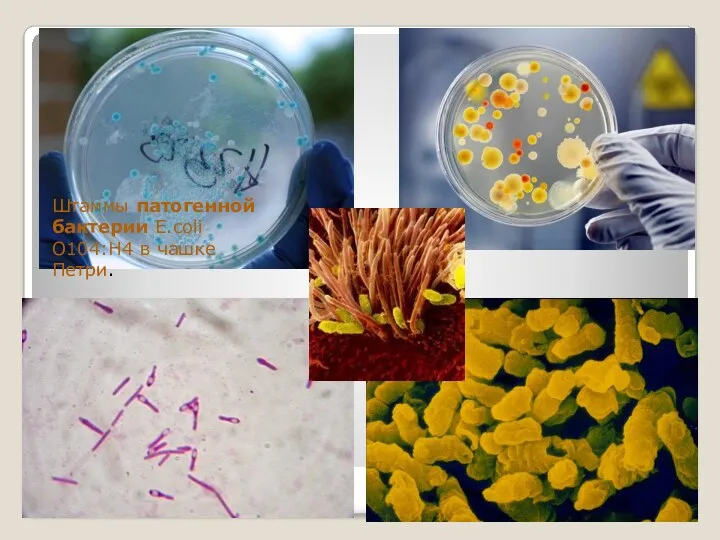 Штаммы патогенной бактерии E.coli O104:H4 в чашке Петри.