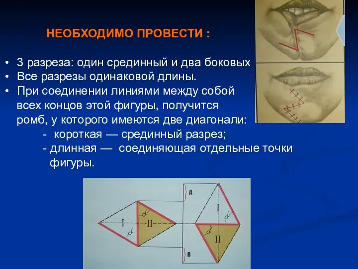 НЕОБХОДИМО ПРОВЕСТИ : 3 разреза: один срединный и два боковых