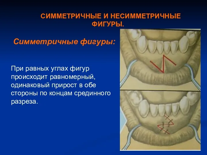 СИММЕТРИЧНЫЕ И НЕСИММЕТРИЧНЫЕ ФИГУРЫ. Симметричные фигуры: При равных углах фигур