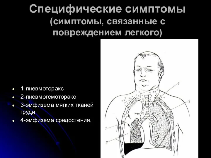 Специфические симптомы (симптомы, связанные с повреждением легкого) 1-пневмоторакс 2-пневмогемоторакс 3-эмфизема мягких тканей груди 4-эмфизема средостения.