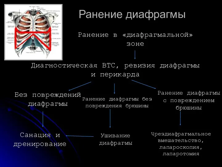 Ранение диафрагмы Ранение в «диафрагмальной» зоне Диагностическая ВТС, ревизия диафрагмы