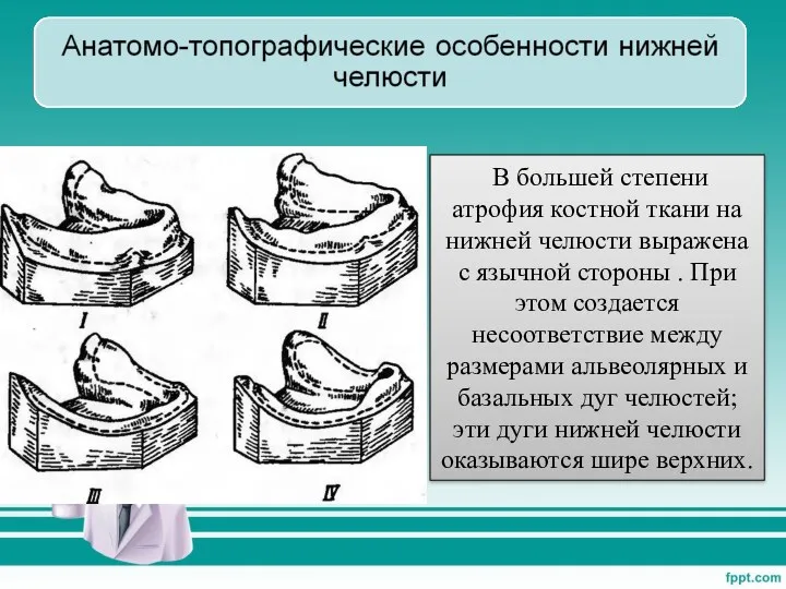 В большей степени атрофия костной ткани на нижней челюсти выражена