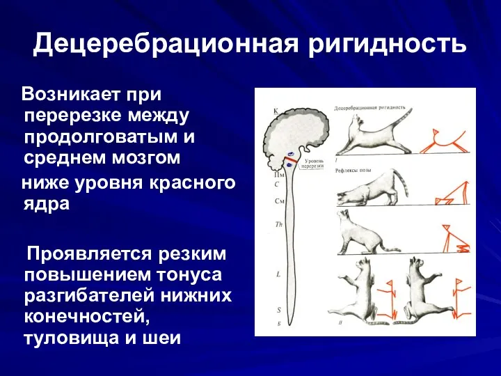 Децеребрационная ригидность Возникает при перерезке между продолговатым и среднем мозгом