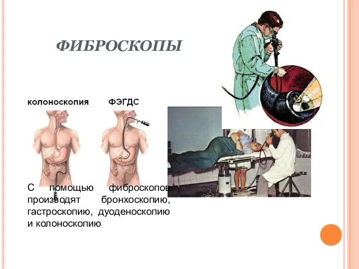 ФИБРОСКОПЫ С помощью фиброскопов производят бронхоскопию, гастроскопию, дуоденоскопию и колоноскопию