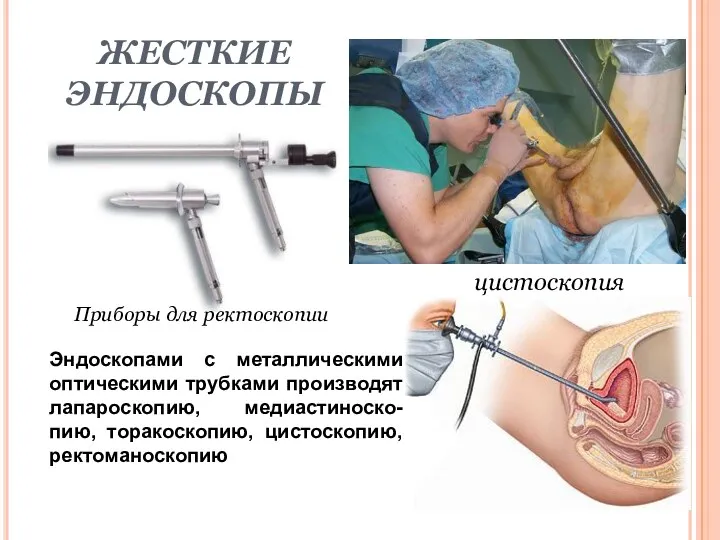 ЖЕСТКИЕ ЭНДОСКОПЫ цистоскопия Приборы для ректоскопии Эндоскопами с металлическими оптическими