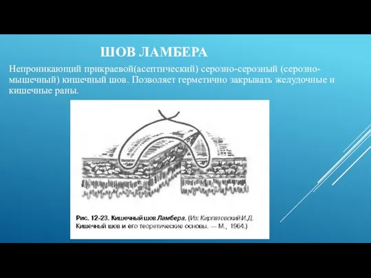 ШОВ ЛАМБЕРА Непроникающий прикраевой(асептический) серозно-серозный (серозно-мышечный) кишечный шов. Позволяет герметично закрывать желудочные и кишечные раны.