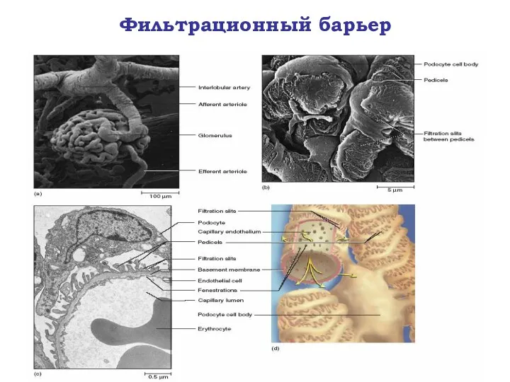 Фильтрационный барьер