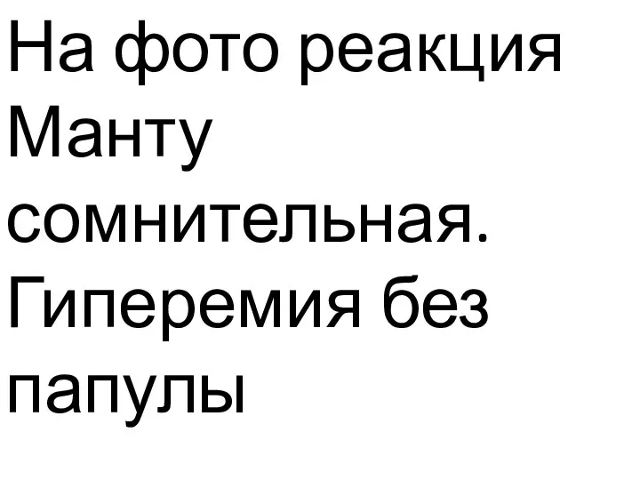 На фото реакция Манту сомнительная. Гиперемия без папулы