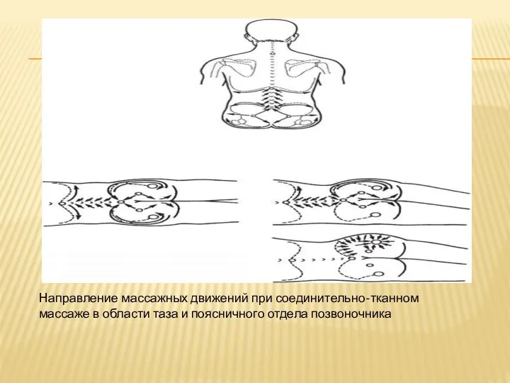 Направление массажных движений при соединительно-тканном массаже в области таза и поясничного отдела позвоночника