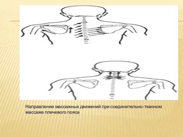 Направление массажных движений при соединительно-тканном массаже плечевого пояса