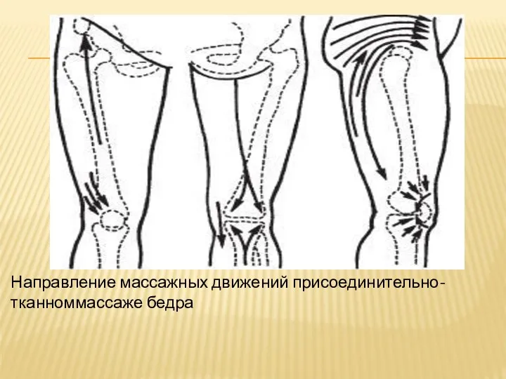 Направление массажных движений присоединительно-тканноммассаже бедра